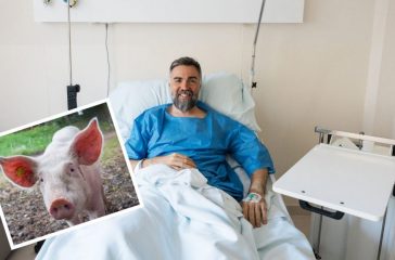 Transplant: Man Becomes First to Receive Pig Kidney, Said to be Making Progress Using Plenty of Oinkment